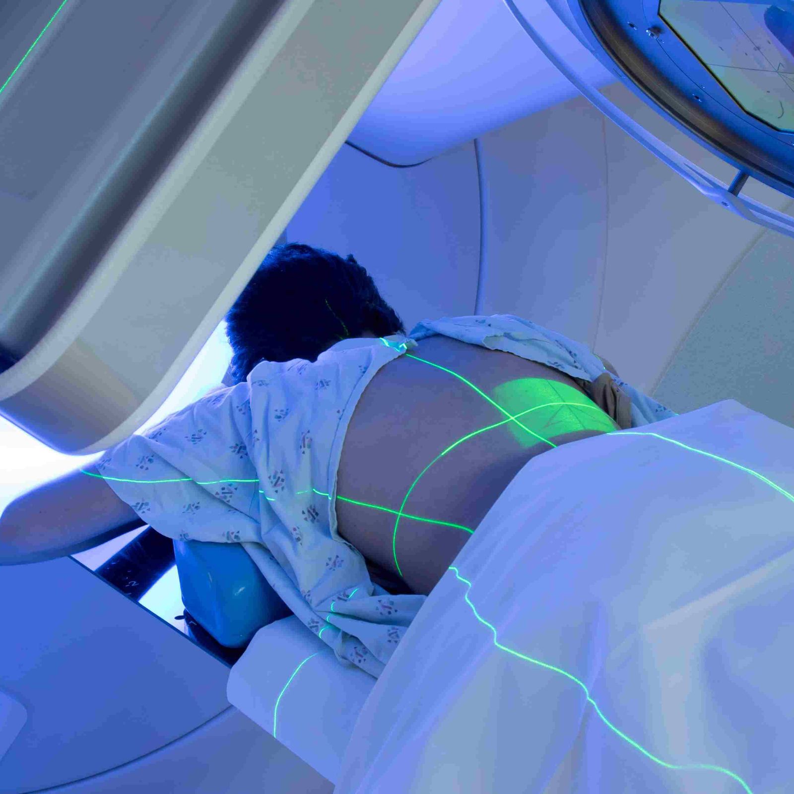 Banner-connectivity by design-Woman receiving radiation therapy