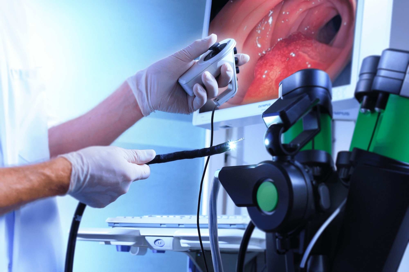 intuitive steering of advanced flexible endoscopes and instruments.