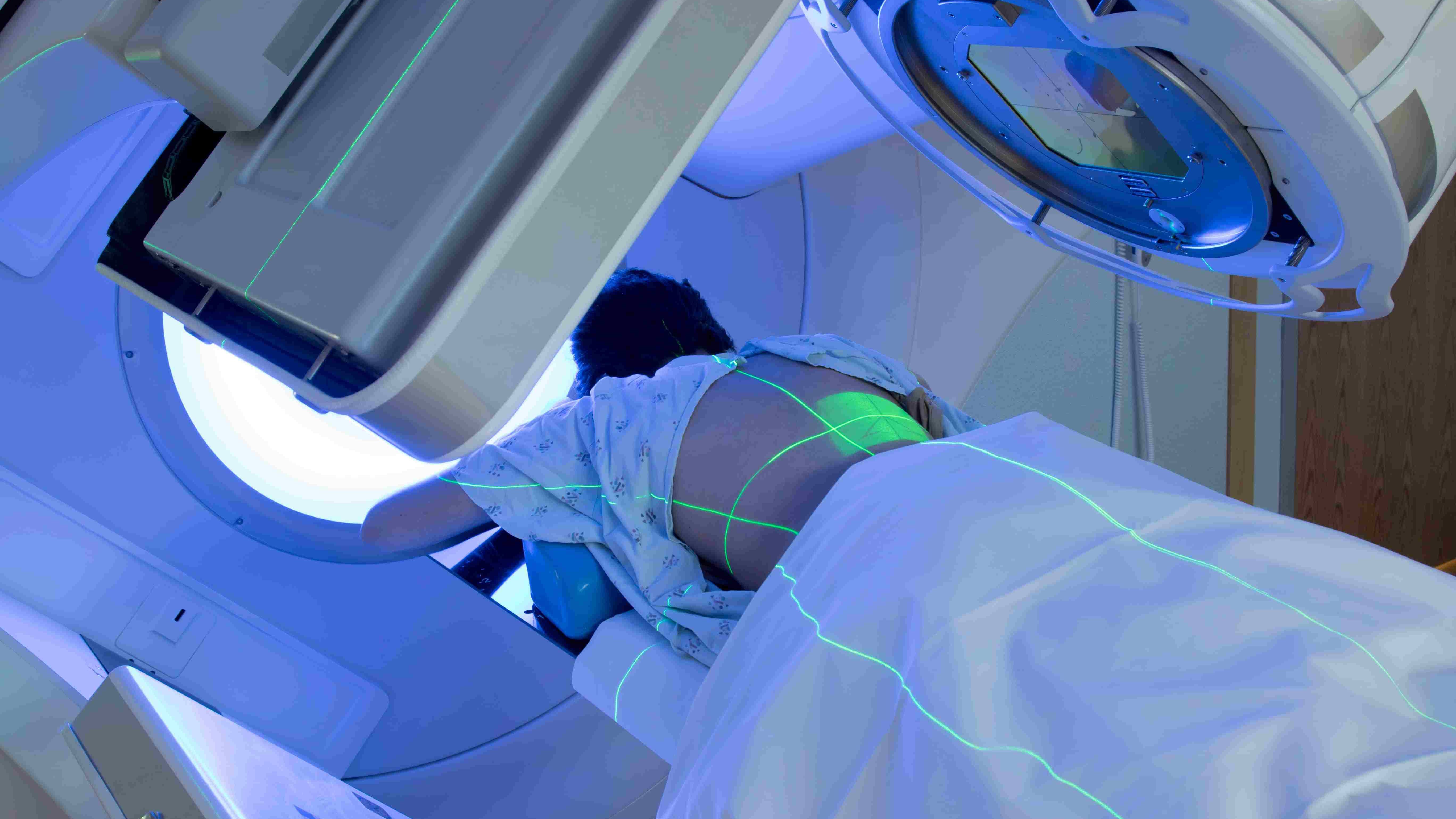 Banner-connectivity by design-Woman receiving radiation therapy